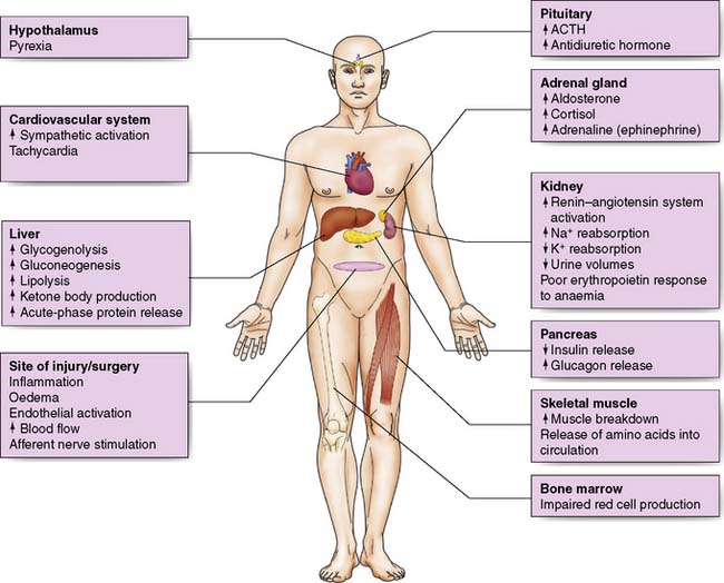 Metabolic Response To Injury Fluid And Electrolyte Balance And Shock Clinical Gate