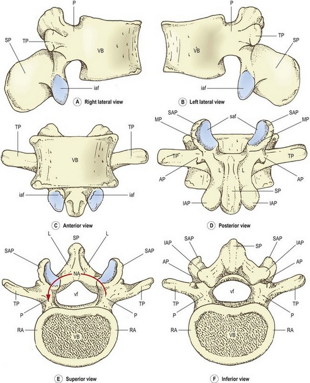 UMLS:C0012249] - Lumbar vertebrae [LI-LV] : Transverse process, Anular  epiphysis, Pedicle of vertebral a…