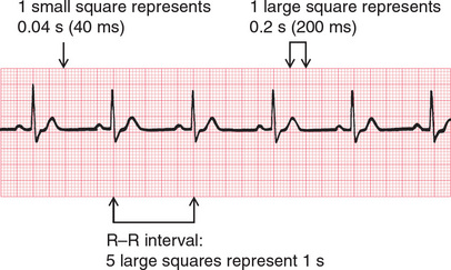 What the ECG is About | Clinical Gate