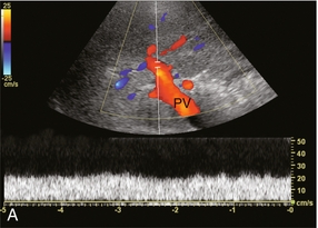 The Liver Clinical Gate