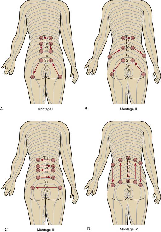 https://clinicalgate.com/wp-content/uploads/2015/06/B9781416037798100168_f16-02ad-9781416037798.jpg