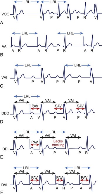 Cardiac Pacing Modes and Terminology