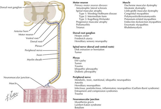 neuromuscular-disorders-clinical-gate