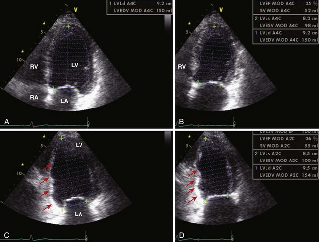 distinguishing-systolic-versus-diastolic-heart-failurea-practical-approach-by-echocardiography