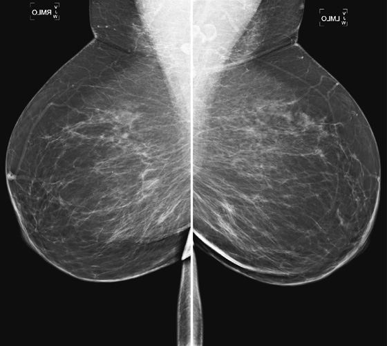 10  Clinical Gate