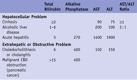 prehepatic jaundice case study