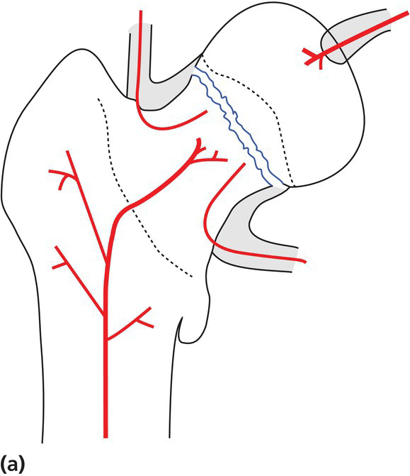 c18-fig-0004